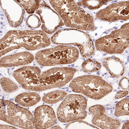 Prohibitin Recombinant Rabbit mAb (S-2679-7)