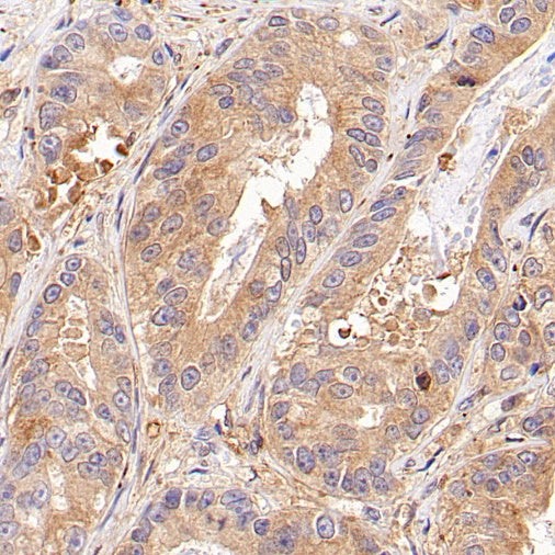 RhoA Recombinant Rabbit mAb (S-1310-159)