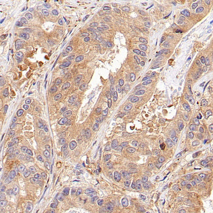 RhoA Recombinant Rabbit mAb (S-1310-159)