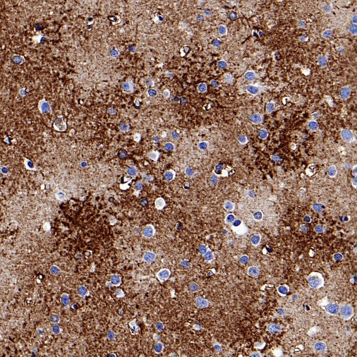AQP4 Recombinant Rabbit mAb (S-1609-62)