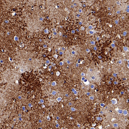 AQP4 Recombinant Rabbit mAb (S-1609-62)