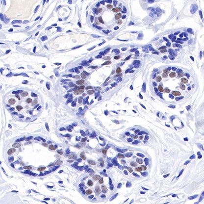 TRPS1 Recombinant Rabbit mAb (S-765-3)