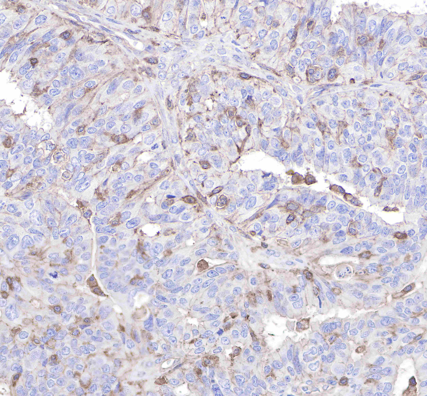 CD206 Recombinant Rabbit mAb(SDT-022-2)