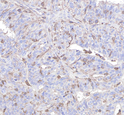 CD206 Recombinant Rabbit mAb(SDT-022-2)