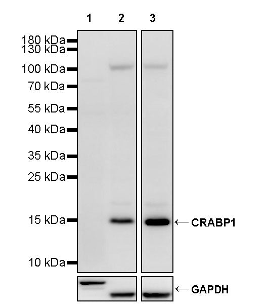 CRABP1 Recombinant Rabbit mAb (S-4212-76)
