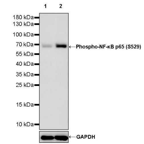 Phospho-NF-κB p65 (S529) Recombinant Rabbit mAb (S-1125-59)