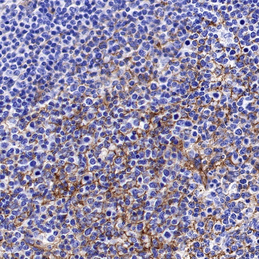 Integrin alpha 5 Recombinant Rabbit mAb (S-381-37)