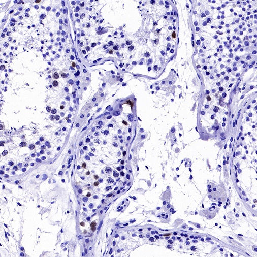 Cyclin A2 Recombinant Rabbit mAb (S-2554-2)