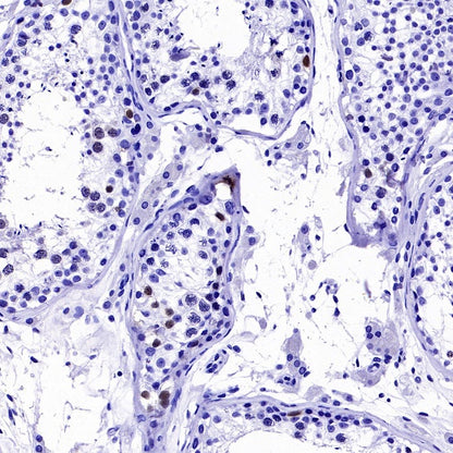 Cyclin A2 Recombinant Rabbit mAb (S-2554-2)