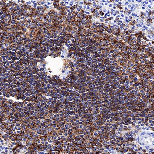 CD20 Recombinant Rabbit mAb (SDT-038-205)