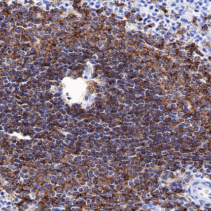 CD20 Recombinant Rabbit mAb (SDT-038-205)