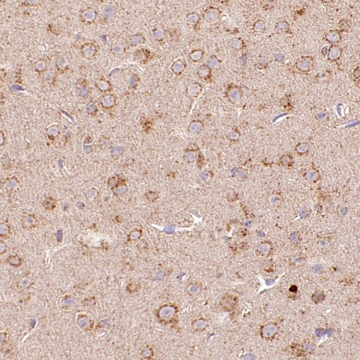 TMEM106B Recombinant Rabbit mAb (S-2362-33)