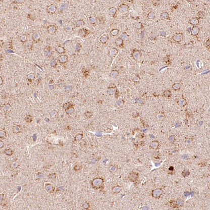 TMEM106B Recombinant Rabbit mAb (S-2362-33)
