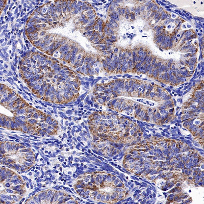 TFAM Recombinant Rabbit mAb (S-1018-53)
