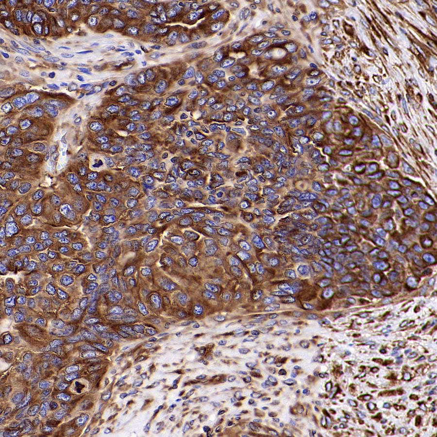 Beta III Tubulin Recombinant Rabbit mAb (S-5529)