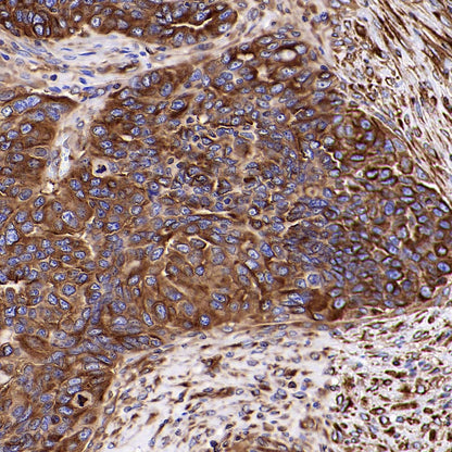Beta III Tubulin Recombinant Rabbit mAb (S-5529)