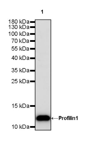 Profilin1 Recombinant Rabbit mAb (S-869-13)
