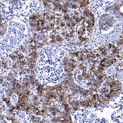 Glypican-3 Recombinant Rabbit mAb (SDT-4064-69-2)