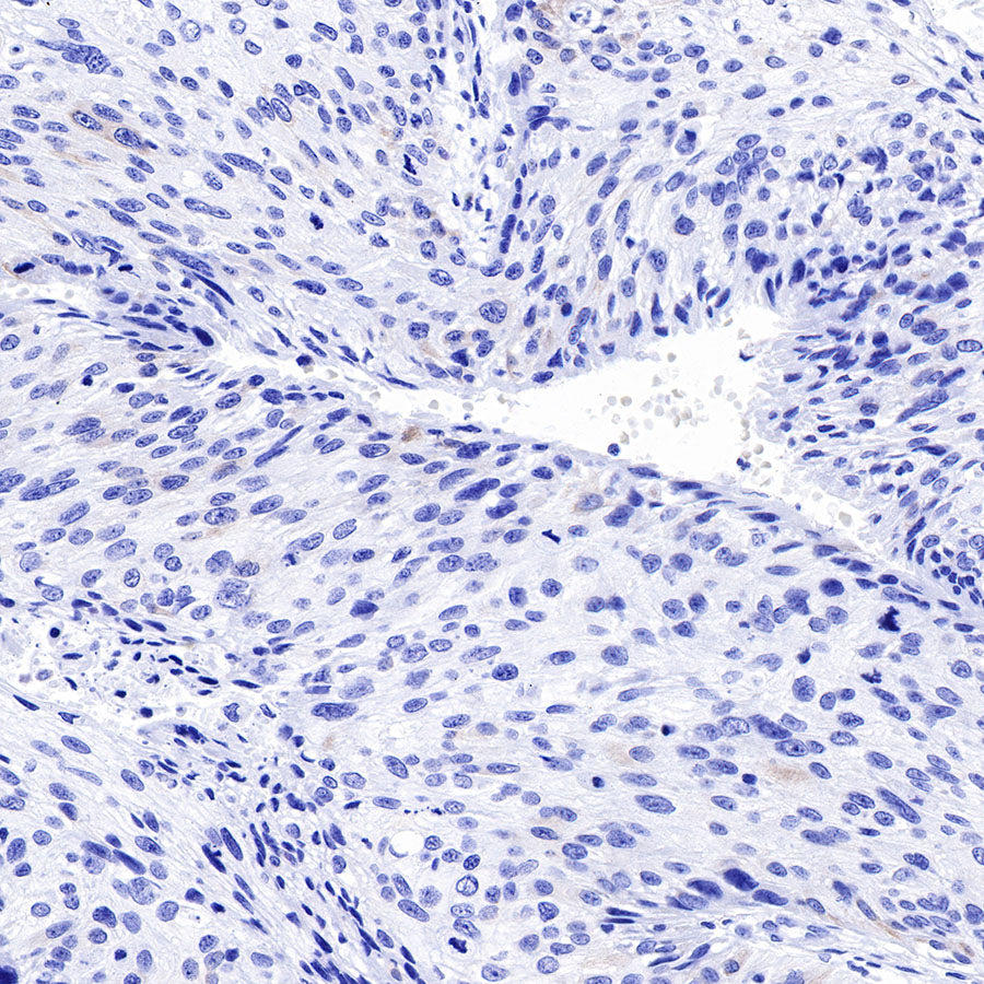 S-RMab® Keratin 18 Recombinant Rabbit mAb (SDT-012-7)