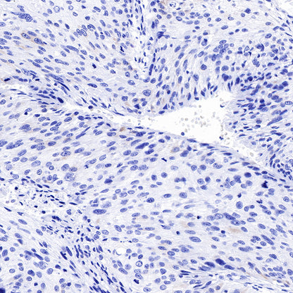 S-RMab® Keratin 18 Recombinant Rabbit mAb (SDT-012-7)