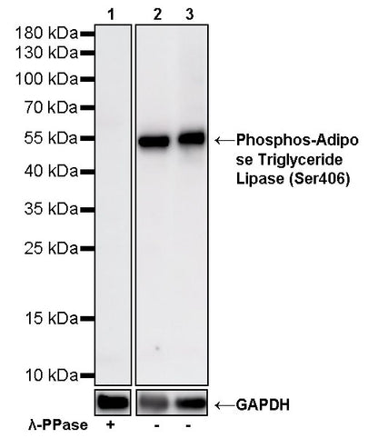 Phosphos-Adipose Triglyceride Lipase (Ser406) Rabbit Polyclonal Antibody