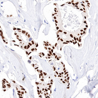 Estrogen Receptor α Recombinant Rabbit mAb (SDT-R371)