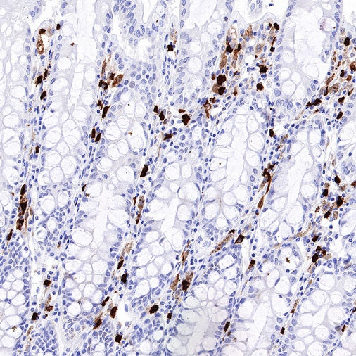 ALOX15 Recombinant Rabbit mAb (S-669-56)