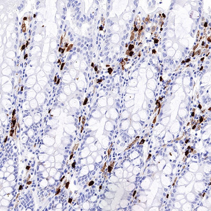 ALOX15 Recombinant Rabbit mAb (S-669-56)