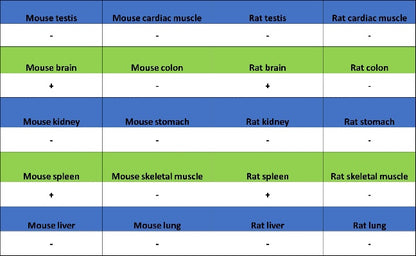 Ctip2 Recombinant Rabbit mAb (S-1375-21)