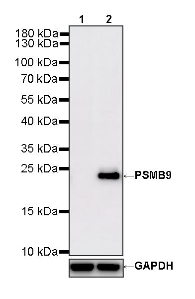 PSMB9 Recombinant Rabbit mAb (S-4183-122)