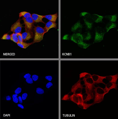 KCNB1 Recombinant Rabbit mAb (S-2527-21)