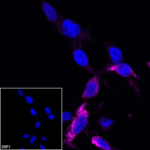 Vimentin Recombinant Rabbit mAb (Alexa Fluor® 647 Conjugate) (S-029-20)