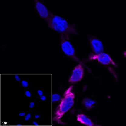 Vimentin Recombinant Rabbit mAb (Alexa Fluor® 647 Conjugate) (S-029-20)