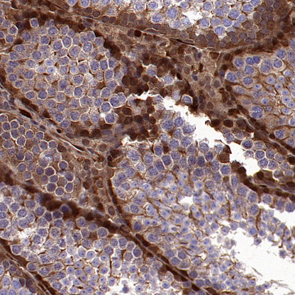 p38 delta/MAPK13 + p38 alpha/MAPK14 Recombinant Mouse mAb (S-3860)