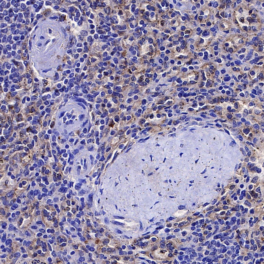 ITGB7 Recombinant Rabbit mAb (S-4138)