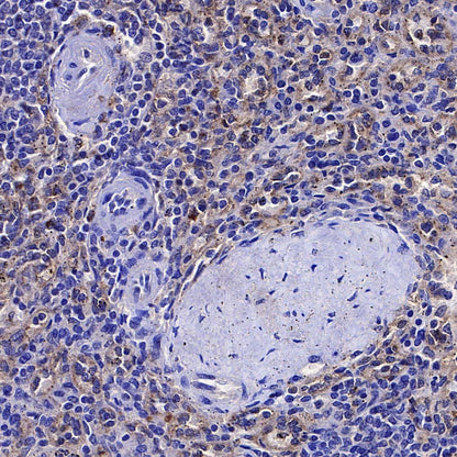 ITGB7 Recombinant Rabbit mAb (S-4138)