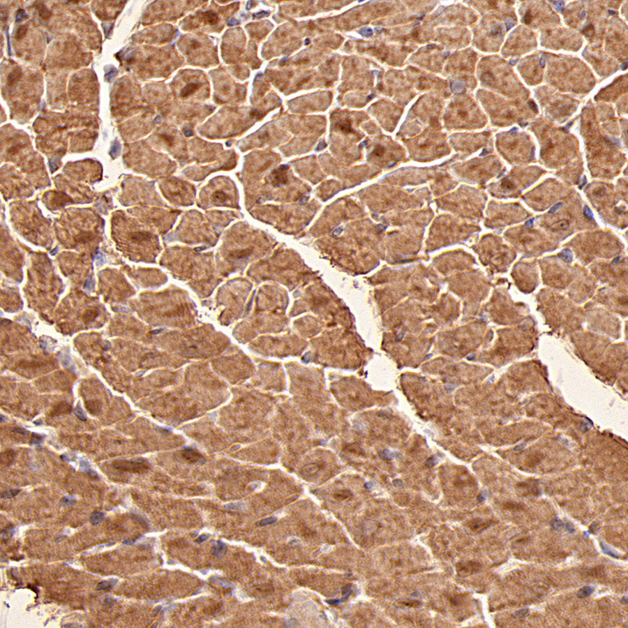 Myoglobin Recombinant Rabbit mAb (S-6197)