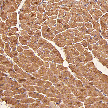 Myoglobin Recombinant Rabbit mAb (S-6197)