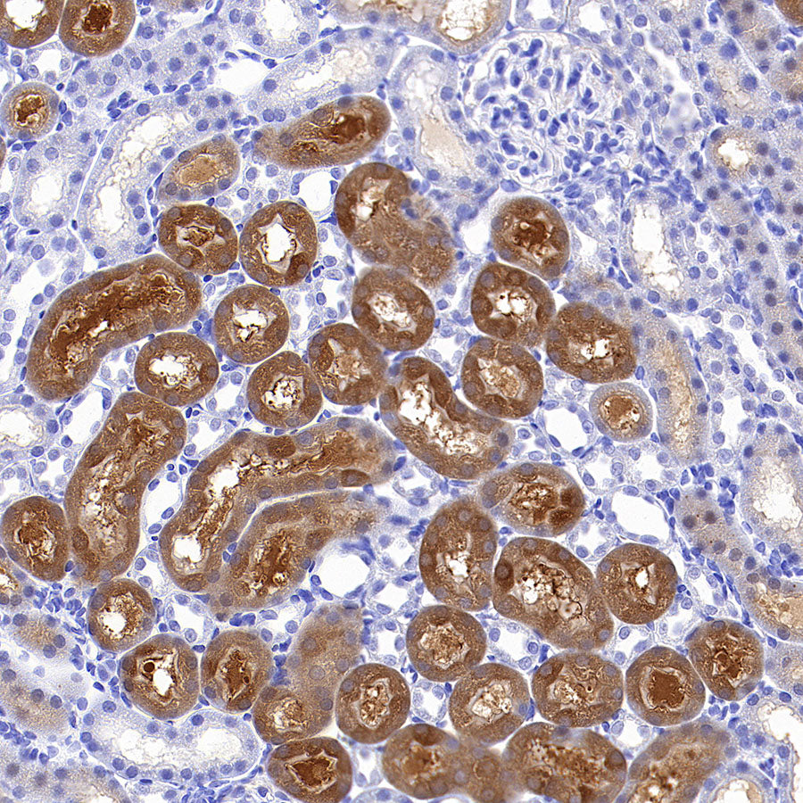 Aass Recombinant Rabbit mAb (S-4170-22)