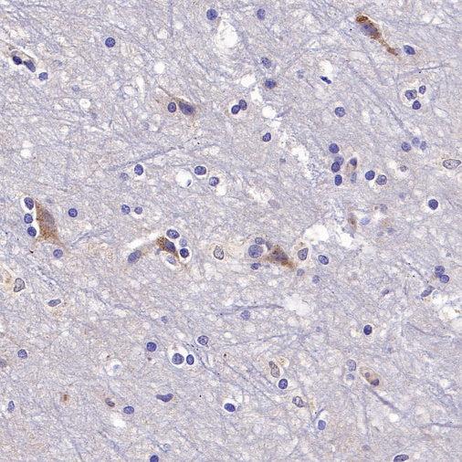 PSEN2 Recombinant Rabbit mAb (S-2084-14)