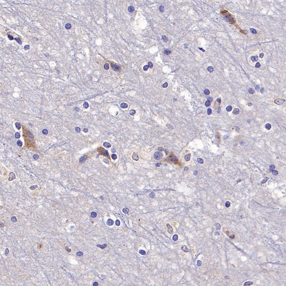PSEN2 Recombinant Rabbit mAb (S-2084-14)