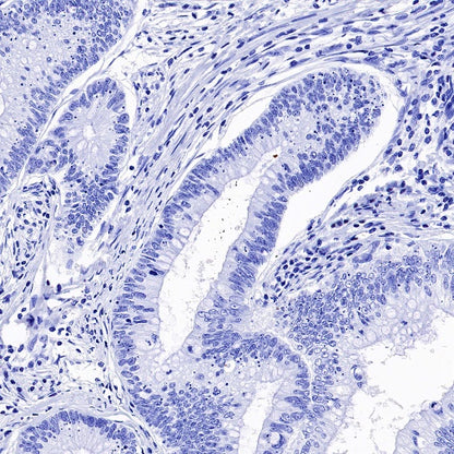 Parvalbumin Recombinant Rabbit mAb (S-1620-10)