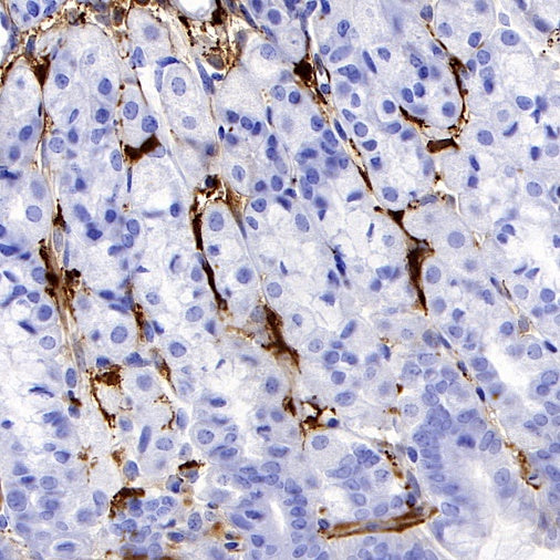 S-RMab® Factor XIIIa Recombinant Rabbit mAb (SDT-R278)