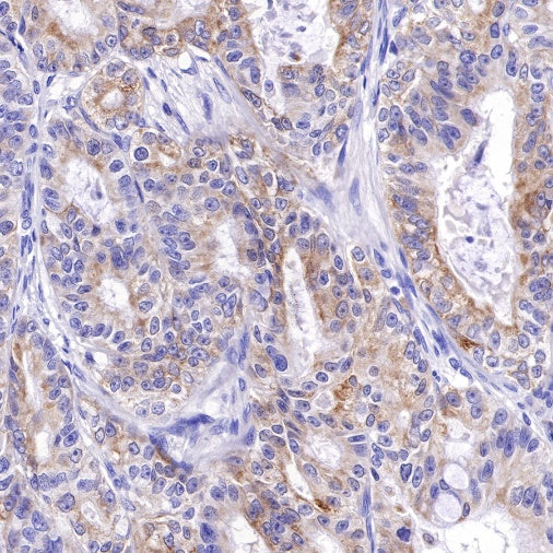 Bcl-xL Recombinant Rabbit mAb (S-487-28)