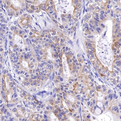 Bcl-xL Recombinant Rabbit mAb (S-487-28)