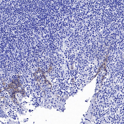 ErbB3 Recombinant Rabbit mAb (SDT-991-73-2)