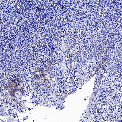 ErbB3 Recombinant Rabbit mAb (SDT-991-73-2)
