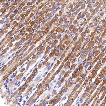 PKM2 Rabbit Polyclonal antibody