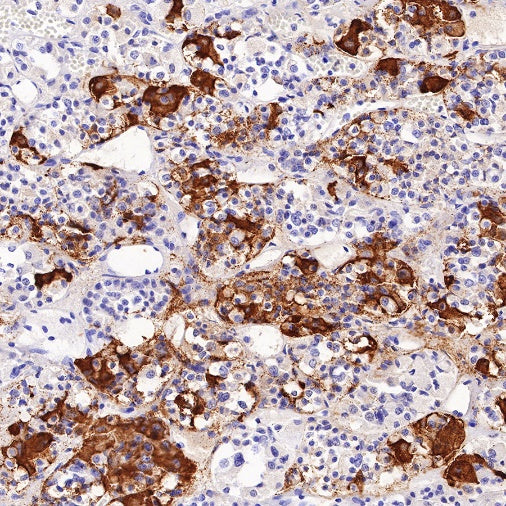 TSHB Recombinant Rabbit mAb (S-537-52)