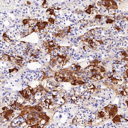 TSHB Recombinant Rabbit mAb (S-537-52)